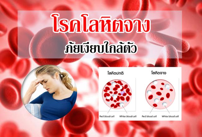 เห็ดหลินจือสมุนไพร สปอร์สารทางยาวิธีแก้รักษาโรคโลหิตจาง บำรุงเลือด