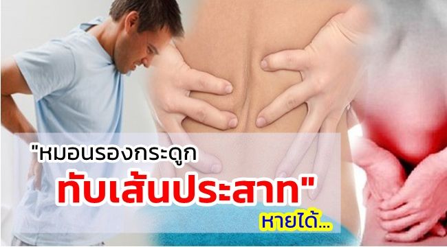 สปอร์เห็ดหลินจือ วิธีรักษาหมอนรองกระดูกกดทับเส้นประสาท หายได้